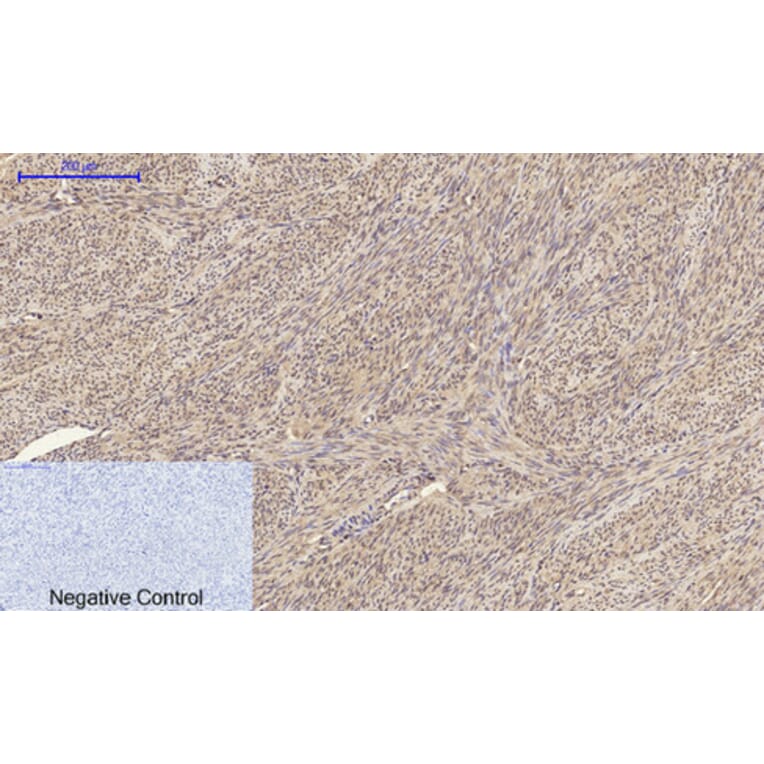 Immunohistochemistry - Anti-BRCA1 Antibody (B7030) - Antibodies.com