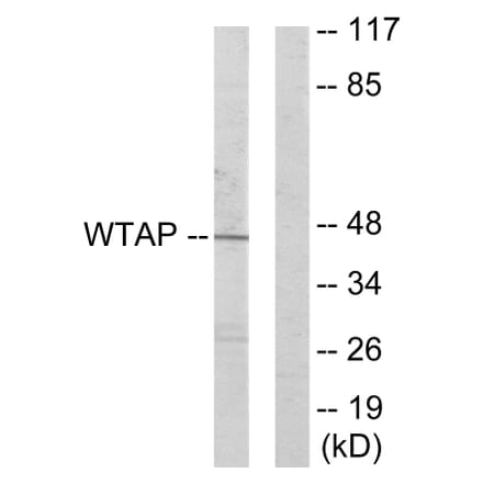 Western Blot - Anti-WTAP Antibody (C11057) - Antibodies.com