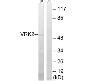 Western Blot - Anti-VRK2 Antibody (C18630) - Antibodies.com