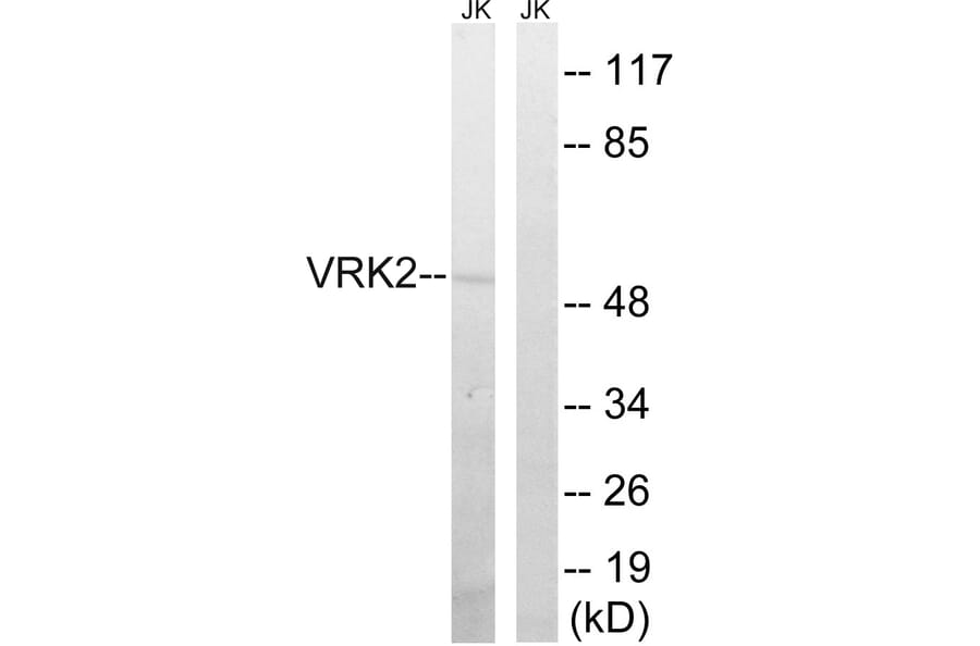 Western Blot - Anti-VRK2 Antibody (C18630) - Antibodies.com