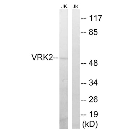Western Blot - Anti-VRK2 Antibody (C18630) - Antibodies.com