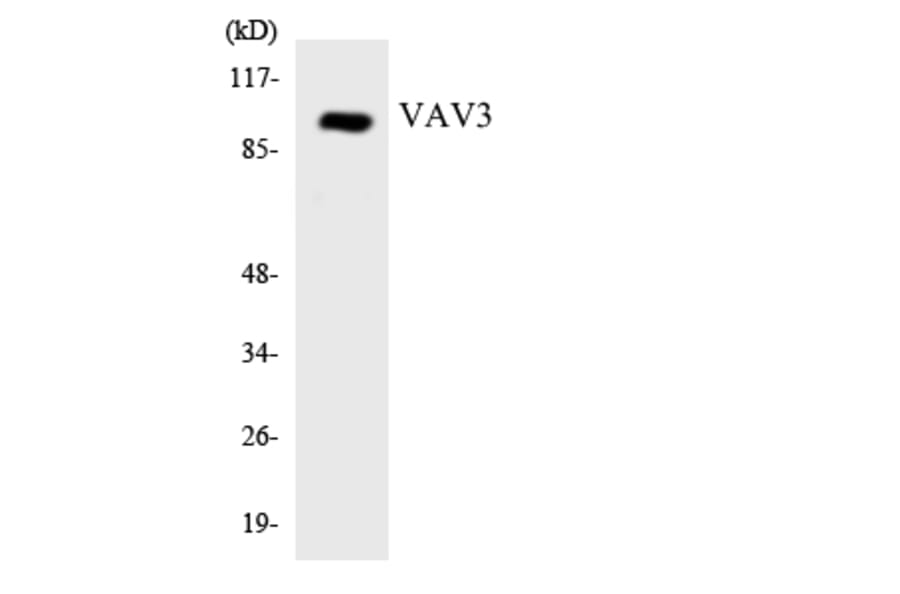 Western Blot - Anti-VAV3 Antibody (R12-3675) - Antibodies.com