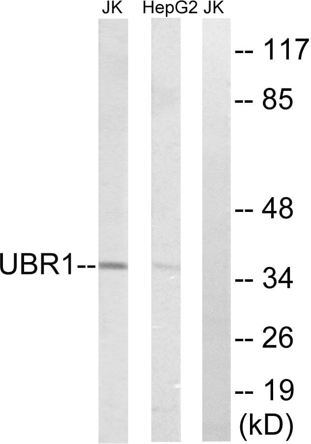 Western blot analysis of lysates from HepG2 and Jurkat cells using Anti-UBR1 Antibody. The right hand lane represents a negative control, where the antibody is blocked by the immunising peptide.