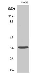 Western blot analysis of various cells using Anti-UBR1 Antibody.
