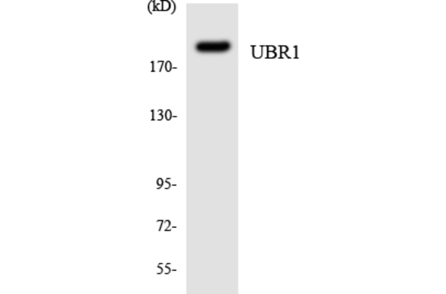 Western Blot - Anti-UBR1 Antibody (R12-3665) - Antibodies.com
