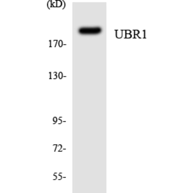 Western Blot - Anti-UBR1 Antibody (R12-3665) - Antibodies.com