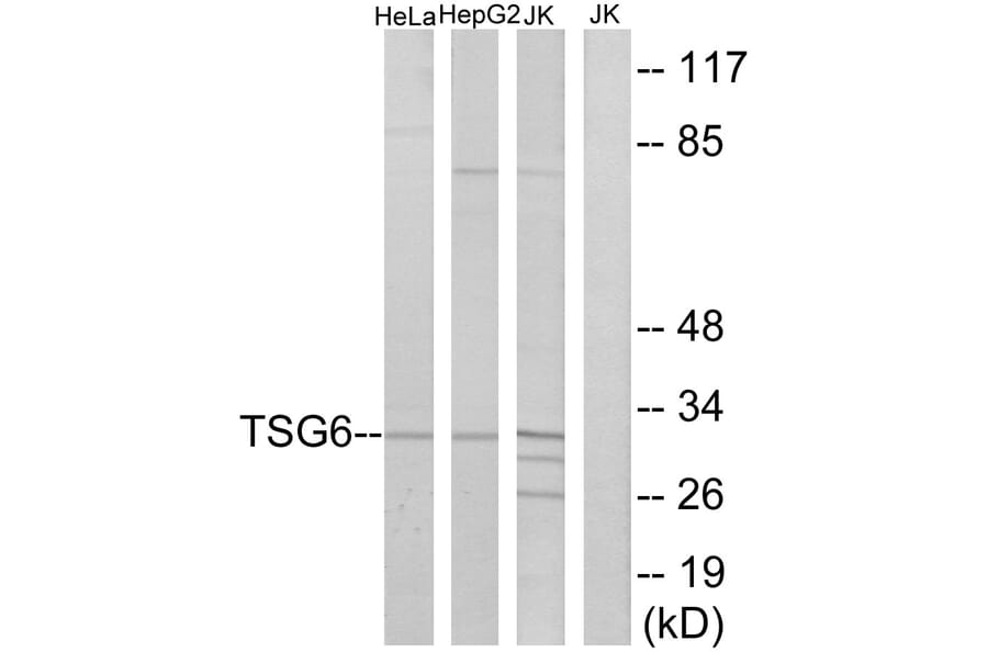 Western Blot - Anti-TSG6 Antibody (C10812) - Antibodies.com