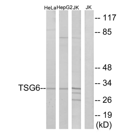 Western Blot - Anti-TSG6 Antibody (C10812) - Antibodies.com