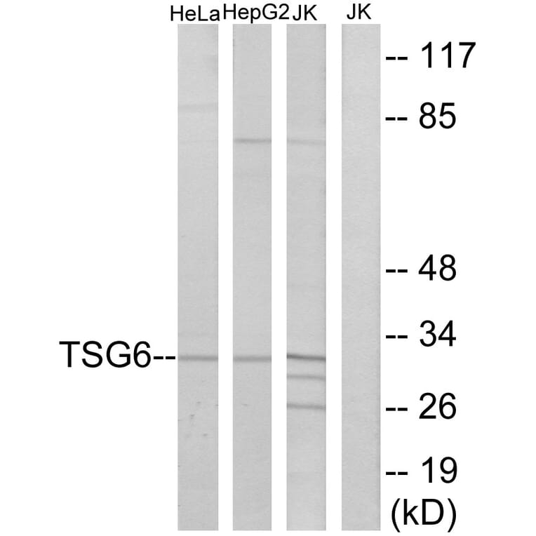 Western Blot - Anti-TSG6 Antibody (C10812) - Antibodies.com