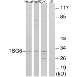 Western Blot - Anti-TSG6 Antibody (C10812) - Antibodies.com