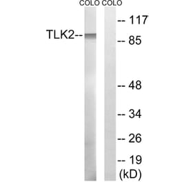 Western Blot - Anti-TLK2 Antibody (C18624) - Antibodies.com