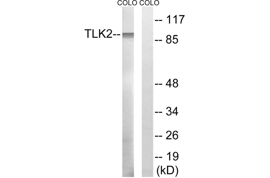 Western Blot - Anti-TLK2 Antibody (C18624) - Antibodies.com