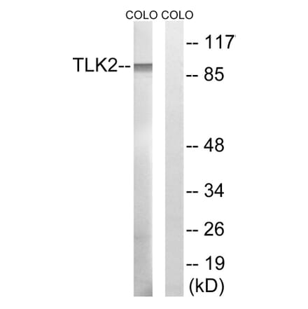 Western Blot - Anti-TLK2 Antibody (C18624) - Antibodies.com