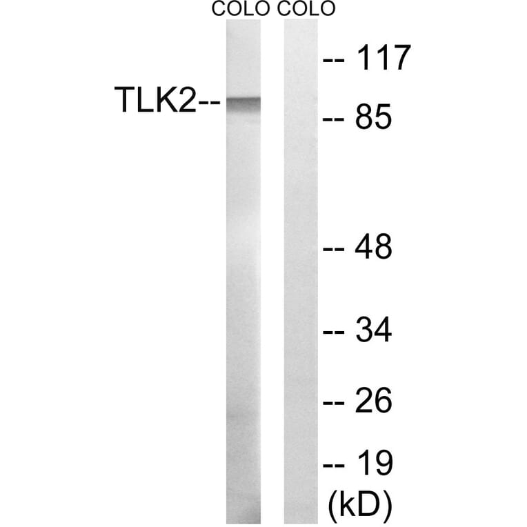 Western Blot - Anti-TLK2 Antibody (C18624) - Antibodies.com