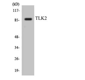 Western Blot - Anti-TLK2 Antibody (R12-3628) - Antibodies.com