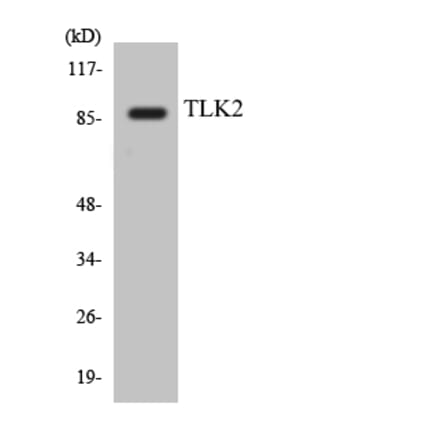 Western Blot - Anti-TLK2 Antibody (R12-3628) - Antibodies.com