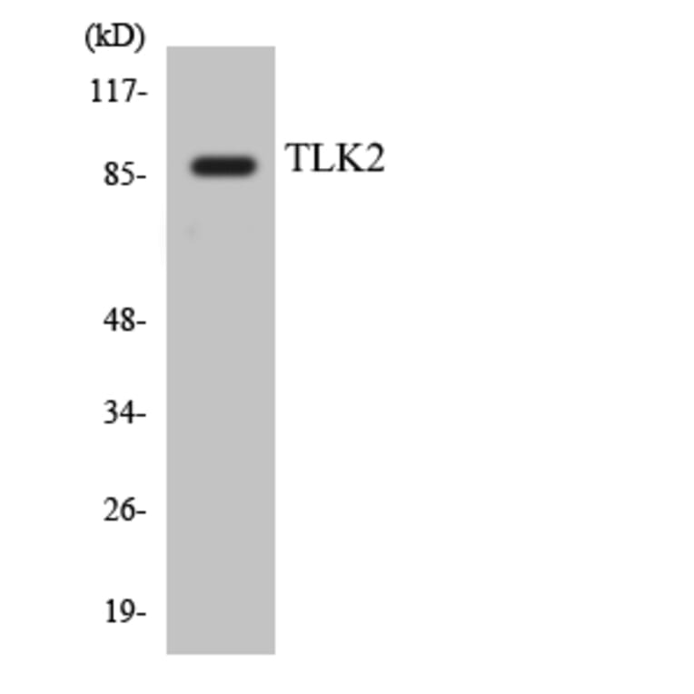 Western Blot - Anti-TLK2 Antibody (R12-3628) - Antibodies.com