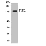 Western Blot - Anti-TLK2 Antibody (R12-3628) - Antibodies.com