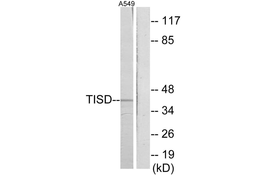 Western Blot - Anti-TISD Antibody (C10632) - Antibodies.com