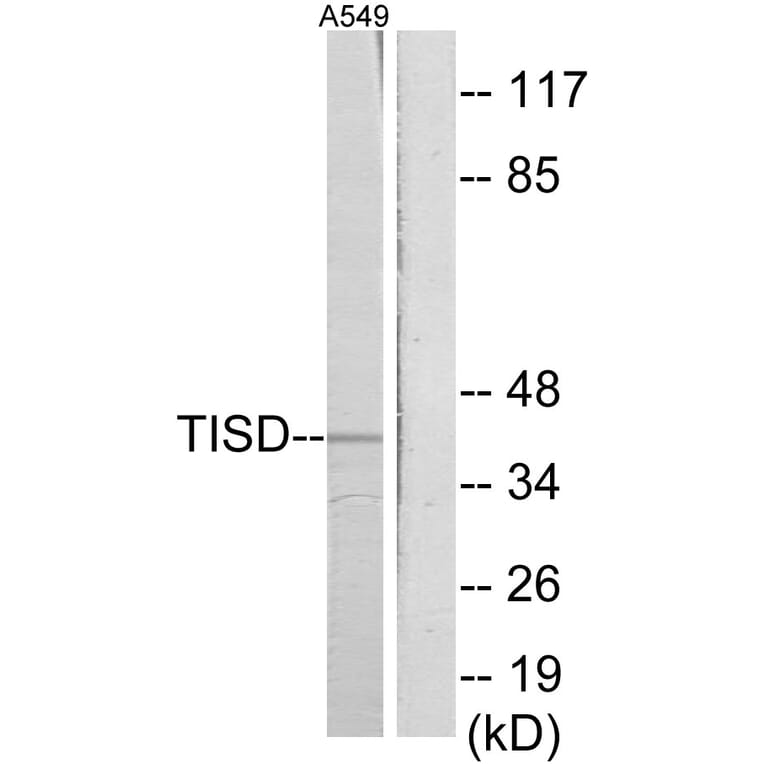 Western Blot - Anti-TISD Antibody (C10632) - Antibodies.com