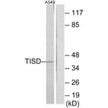Western Blot - Anti-TISD Antibody (C10632) - Antibodies.com