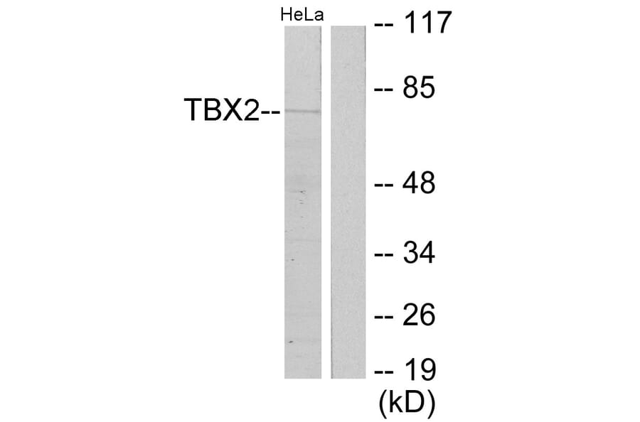 Western Blot - Anti-TBX2 Antibody (C10957) - Antibodies.com
