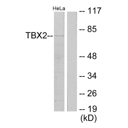 Western Blot - Anti-TBX2 Antibody (C10957) - Antibodies.com