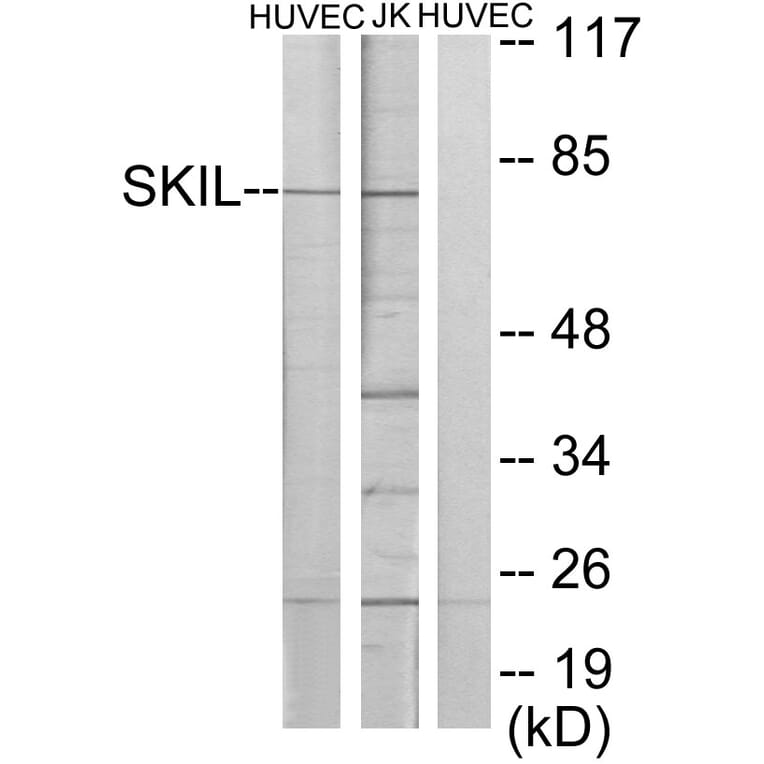 Western Blot - Anti-SKIL Antibody (C10353) - Antibodies.com