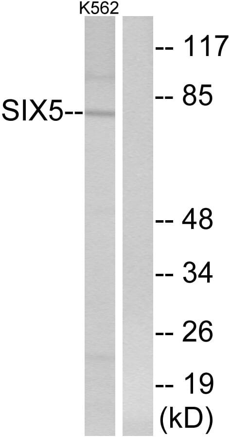 Western blot analysis of lysates from K562 cells using Anti-SIX5 Antibody. The right hand lane represents a negative control, where the antibody is blocked by the immunising peptide.