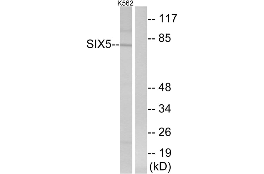 Western Blot - Anti-SIX5 Antibody (C16357) - Antibodies.com