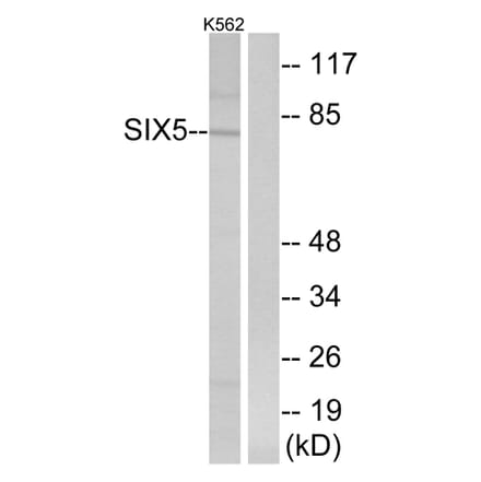 Western Blot - Anti-SIX5 Antibody (C16357) - Antibodies.com