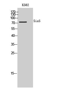 Western blot analysis of K562 cells using Anti-SIX5 Antibody.