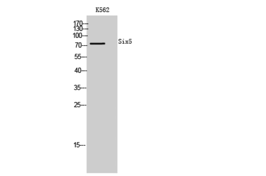 Western Blot - Anti-SIX5 Antibody (C16357) - Antibodies.com