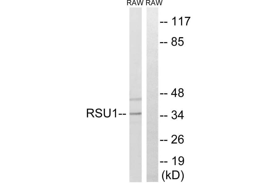 Western Blot - Anti-RSU1 Antibody (C18198) - Antibodies.com