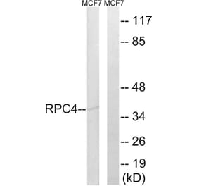 Western Blot - Anti-RPC4 Antibody (C15477) - Antibodies.com