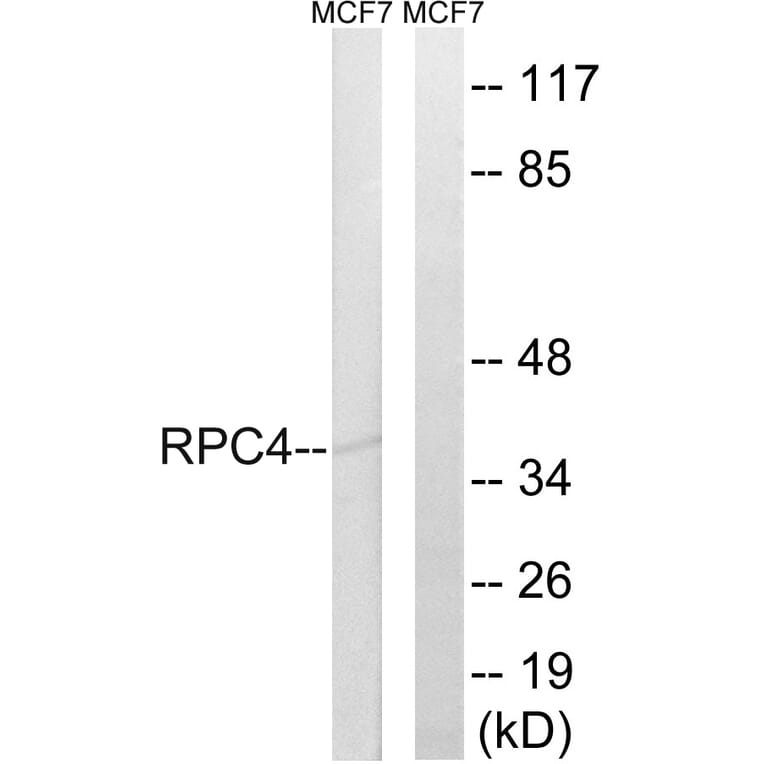 Western Blot - Anti-RPC4 Antibody (C15477) - Antibodies.com