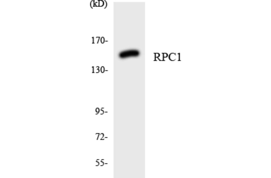 Western Blot - Anti-RPC1 Antibody (R12-3449) - Antibodies.com