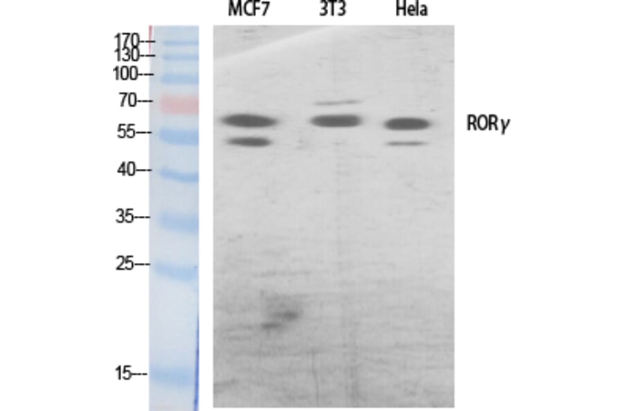 Western Blot - Anti-RORG Antibody (C10676) - Antibodies.com