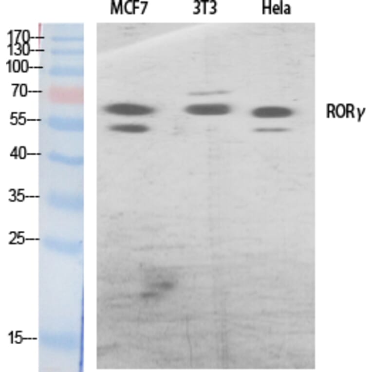 Western Blot - Anti-RORG Antibody (C10676) - Antibodies.com