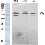 Western Blot - Anti-RORG Antibody (C10676) - Antibodies.com