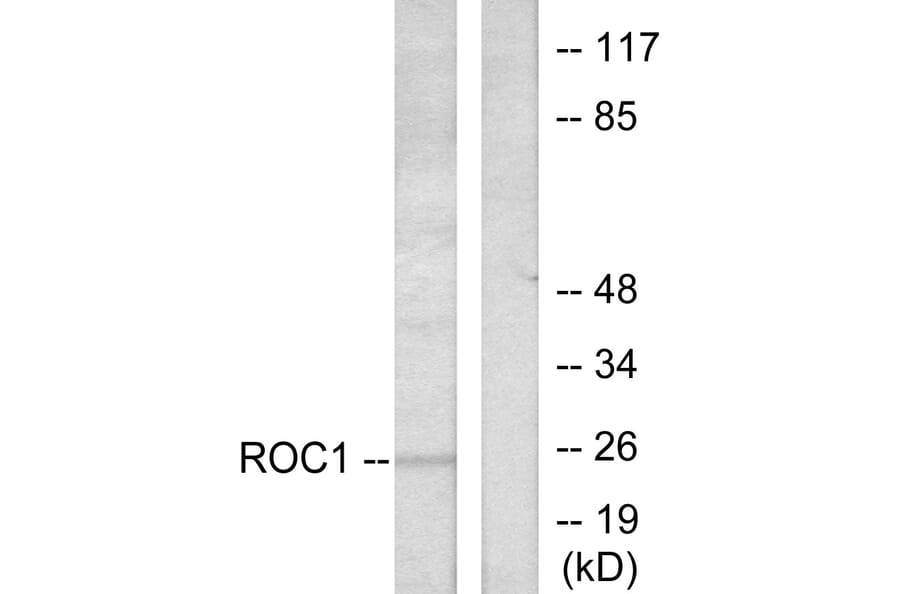 Western Blot - Anti-RIT1 Antibody (C0317) - Antibodies.com