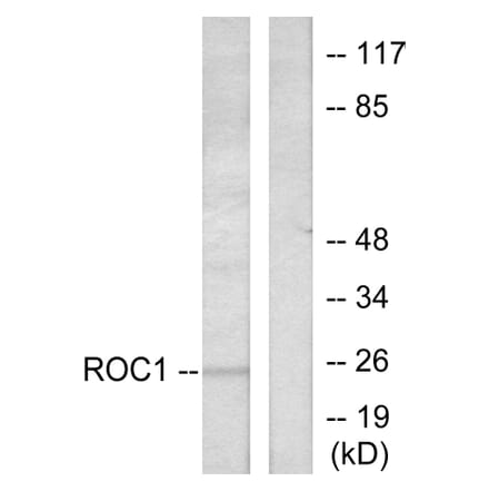 Western Blot - Anti-RIT1 Antibody (C0317) - Antibodies.com