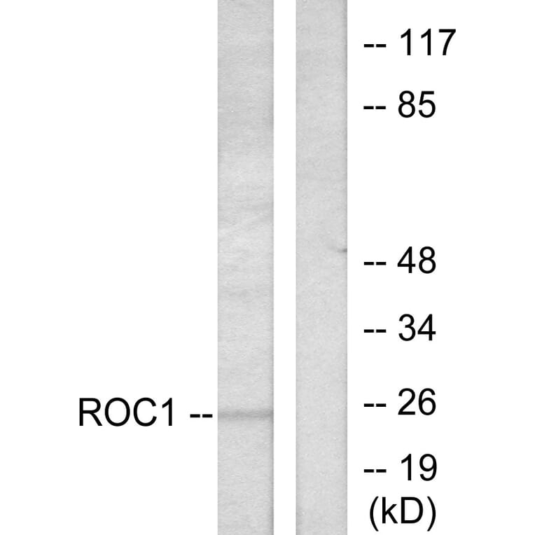 Western Blot - Anti-RIT1 Antibody (C0317) - Antibodies.com