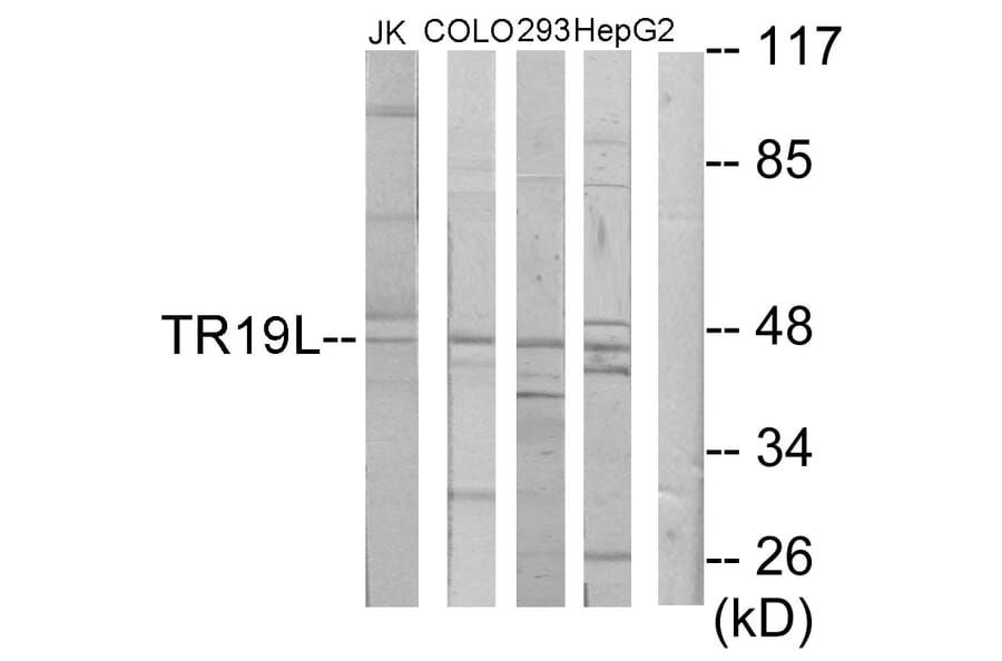 Western Blot - Anti-RELT Antibody (C11468) - Antibodies.com