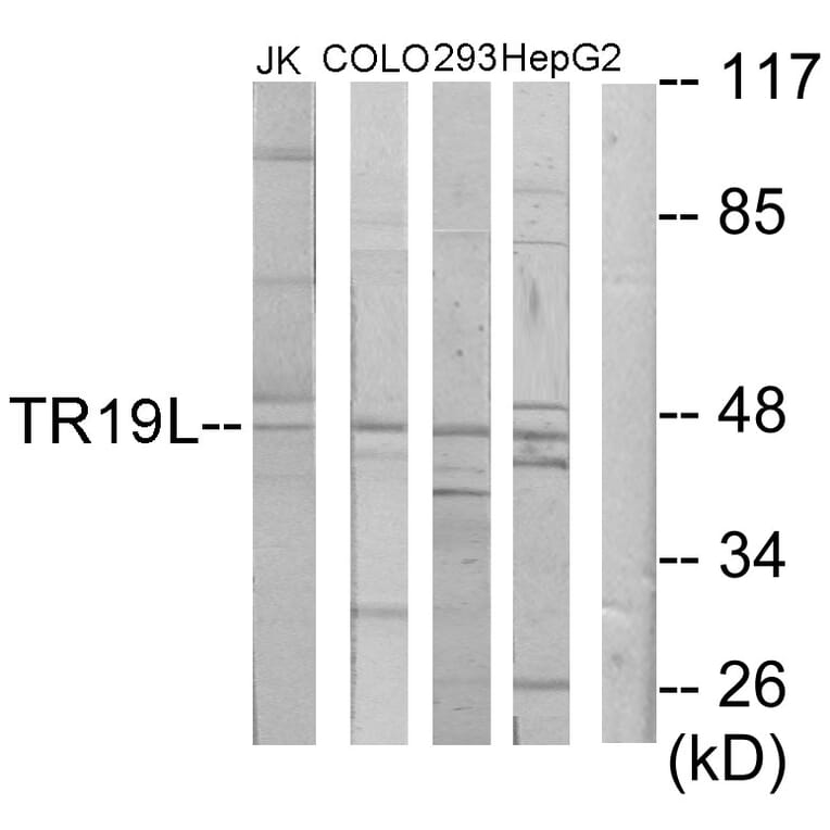 Western Blot - Anti-RELT Antibody (C11468) - Antibodies.com