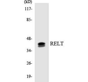 Western Blot - Anti-RELT Antibody (R12-3418) - Antibodies.com