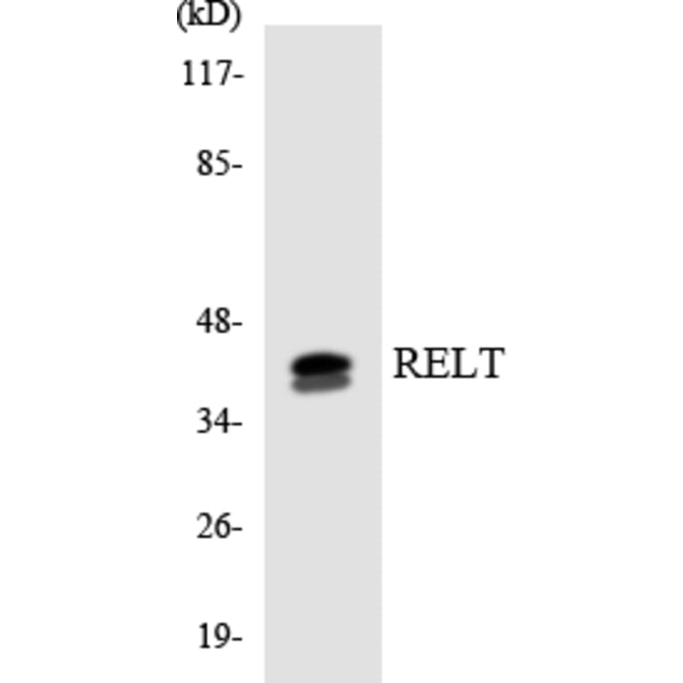 Western Blot - Anti-RELT Antibody (R12-3418) - Antibodies.com