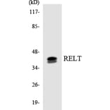 Western Blot - Anti-RELT Antibody (R12-3418) - Antibodies.com