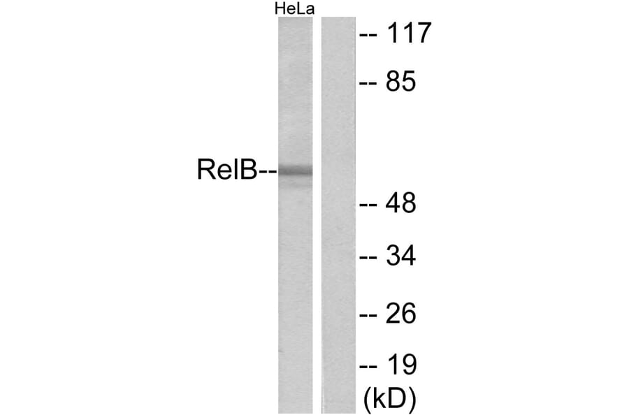 Western Blot - Anti-RelB Antibody (B7212) - Antibodies.com