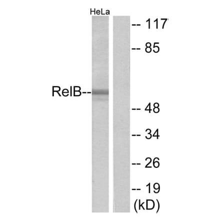 Western Blot - Anti-RelB Antibody (B7212) - Antibodies.com